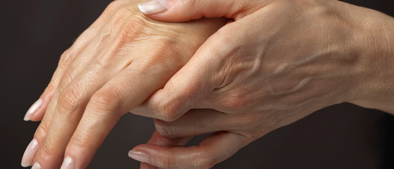 Arthritis the facts