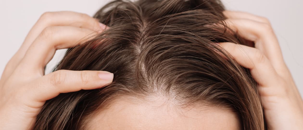 why is scalp health so important 1260